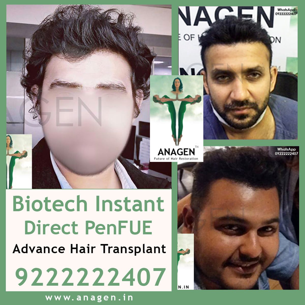 Anagen Hair Transplant Clinic (@Anagen_Clinic) / Twitter Anagen Hair Transplant Clinic (@Anagen_Clinic) / Twitter