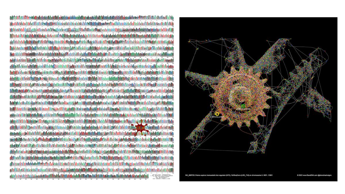 HaemAus's tweet photo. Looking for new artwork? Two of @dansdnadesigns  now available for sale through our Overload shop https://t.co/Tdq9E6dyCv 

The artist, A/Prof Dan Wallace, is a Senior Lecturer &amp; medical researcher at QUT. He teaches molecular biology &amp; genetics. #haemochromatosis #ironoverload https://t.co/lpOcL1DLzW