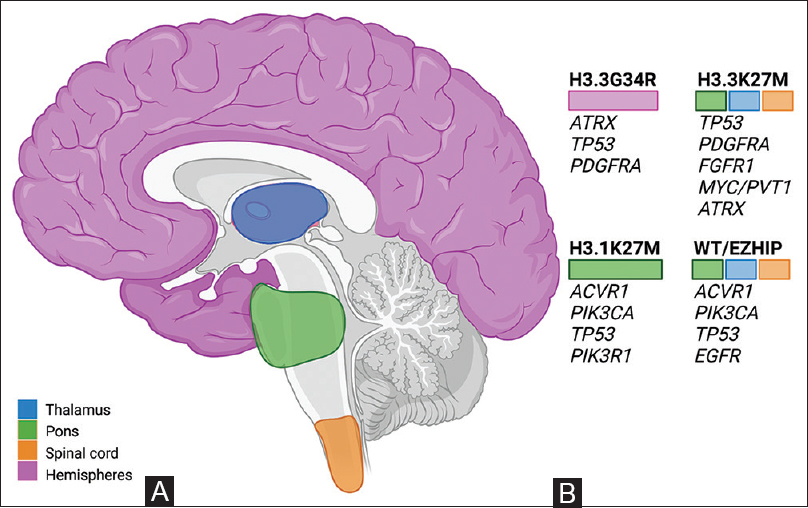 Glioma17's tweet photo. #Glioma [Review] The diverse landscape of histone-mutant pediatric high-grade gliomas: A narrative review
#pediatrichighgradegliomas #histonemutant 
https://t.co/jC4F2GEYKT https://t.co/nDvuSCXoSA