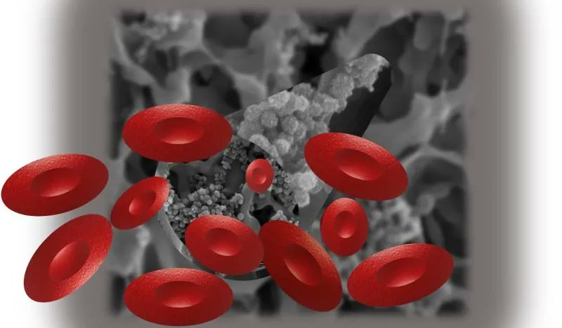 Nicolaus Copernicus University designed a new #composite #material for blood-related applications, using the HPT-100 to perform #surfacemodification of the composites they demonstrated that low blood platelet adhesion could be achieved with #zerotoxicity. buff.ly/3BDltHI
