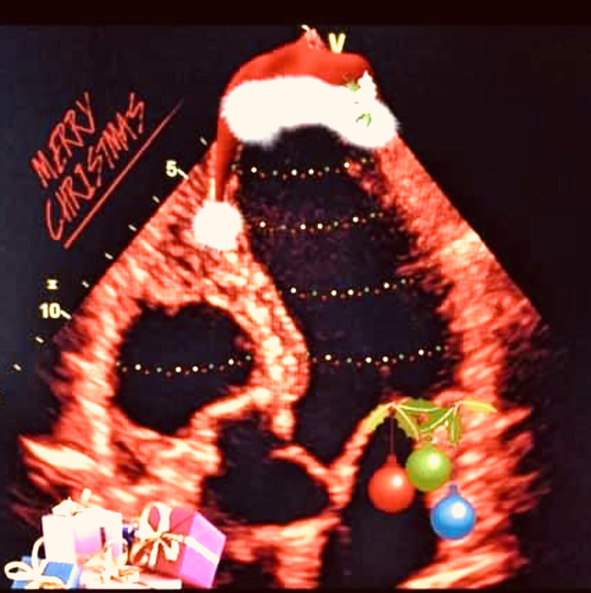 Los Angeles Echo Society tweet media