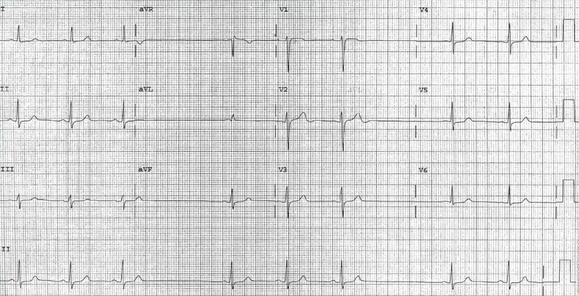 manual-of-medicine-on-twitter-a-62-y-o-man-with-2-weeks-of