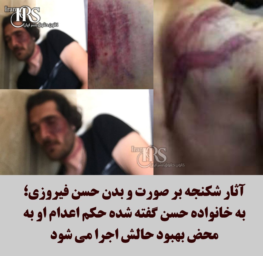 MarianoGiustino's tweet photo. Quando parlate del regime in #Iran, parlate di #HasanFirouzi, 34 anni, papà di una piccola di 18 mesi, ridotto in fin di vita dalle torture, dagli stupri, dalle sevizie delle guardie rivoluzionarie. Firouzi è stato condannato a morte perché vuole un Iran liberato 

@RadioRadicale https://t.co/snjnnuepE4