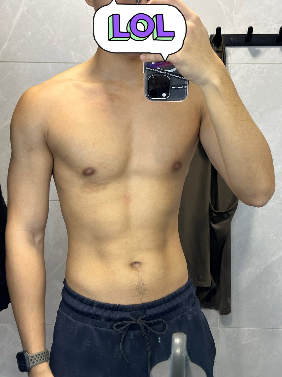 NWVT12's tweet photo. 聖誕party之前要操下個胸
但係嚟緊可能要認真唞吓
#同唔到bb過第一個聖誕🥹
#sadsad https://t.co/bJNMz4L0Vs