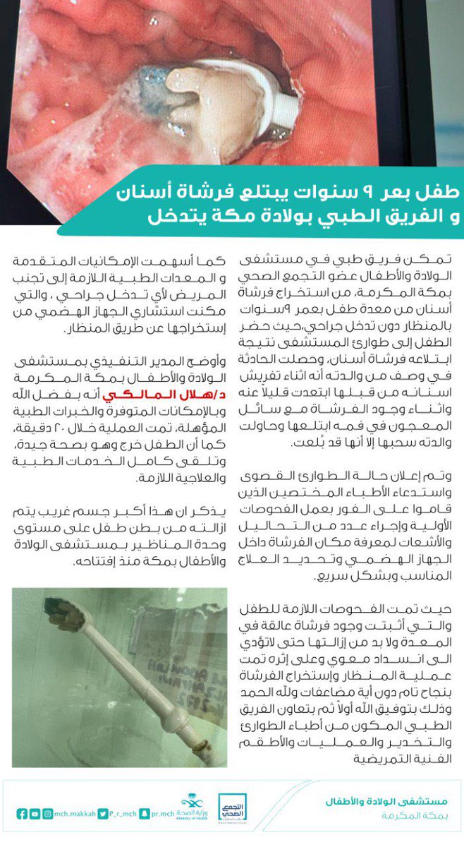 p_r_mch's tweet photo. #خبر|🗞
طفل بعمر 9 سنوات يبتلع فرشاة أسنان والفريق الطبي بولادة مكة يتدخل https://t.co/hW8FzcLHLW
