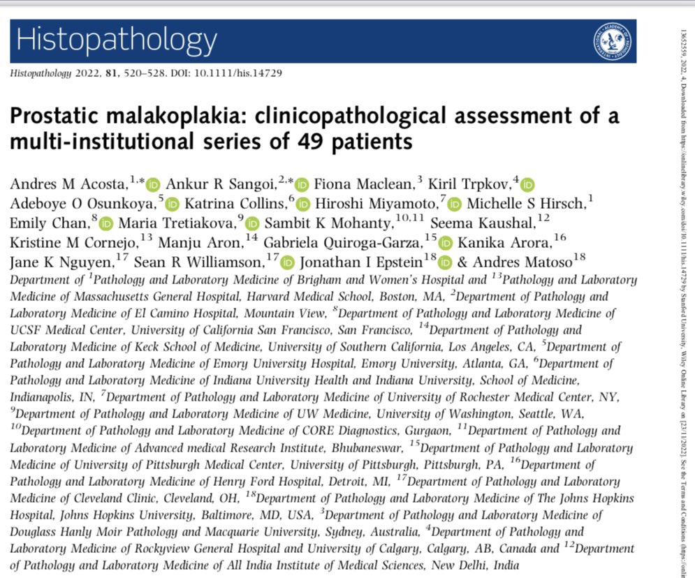 slusagar's tweet photo. 👏🏽Dx: malakoplakia! 

⬇️VonKossa stain (my fav for👀MG bodies)

✔️recent #GUpath study by @Andres_M_Acosta @Andres_Matoso &amp; I did

PMID: 35876721
https://t.co/1UQkZAOMfs https://t.co/EAePQcmpnD