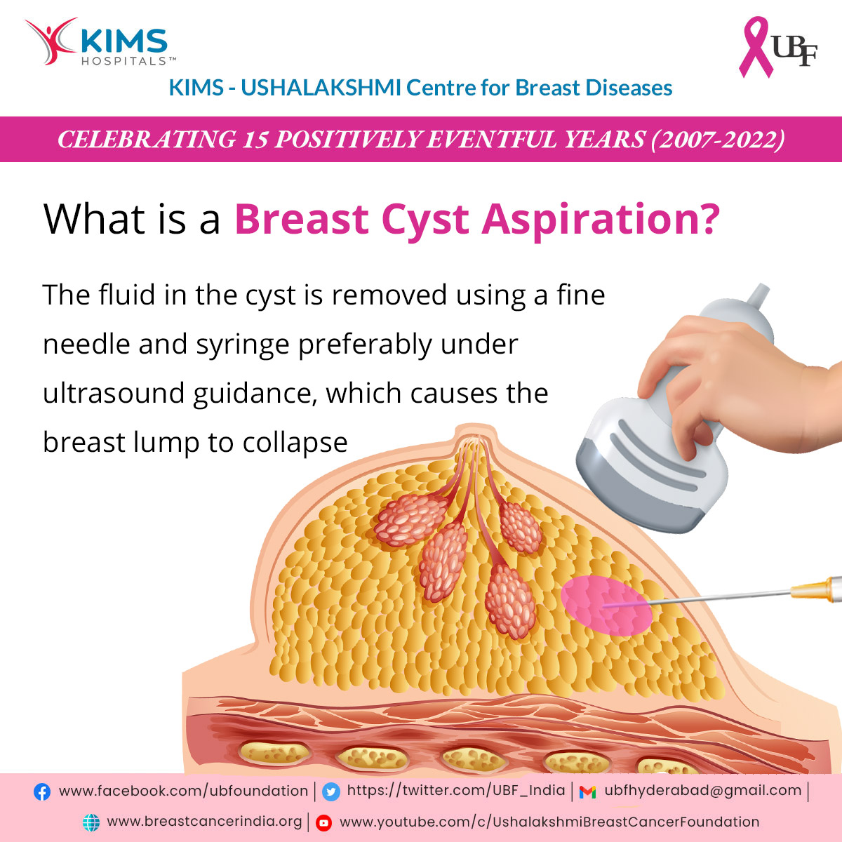 UBF_India's tweet photo. Most cysts DO NOT need to be aspirated 

Breast cyst aspiration is a procedure to drain out the fluid in the cyst. It is only undertaken if the cyst is very large/painful/infected/suspicious of malignancy(rare)

#breastcyst #breastcancer #breastcanceraware #breastcancerawareness https://t.co/S4sRozyQ7B