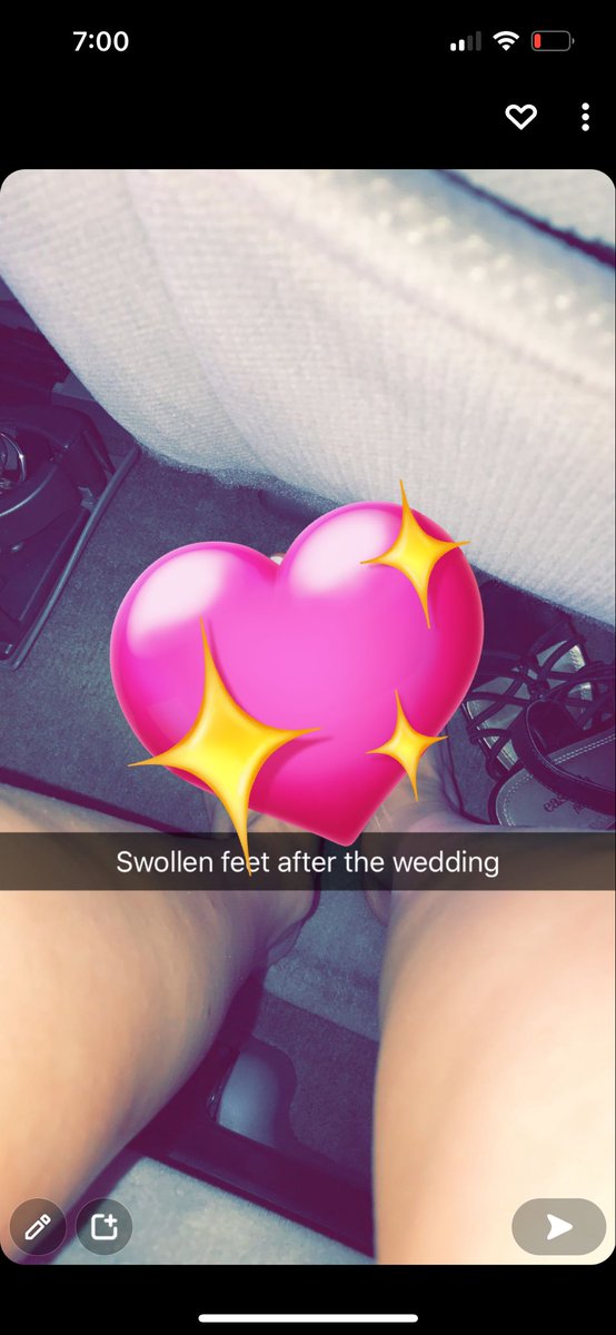 NaturalFeet_'s tweet photo. DM to see uncensored 💖

#feet #feetworship #feetpicsforsales https://t.co/1P00jGMCBi