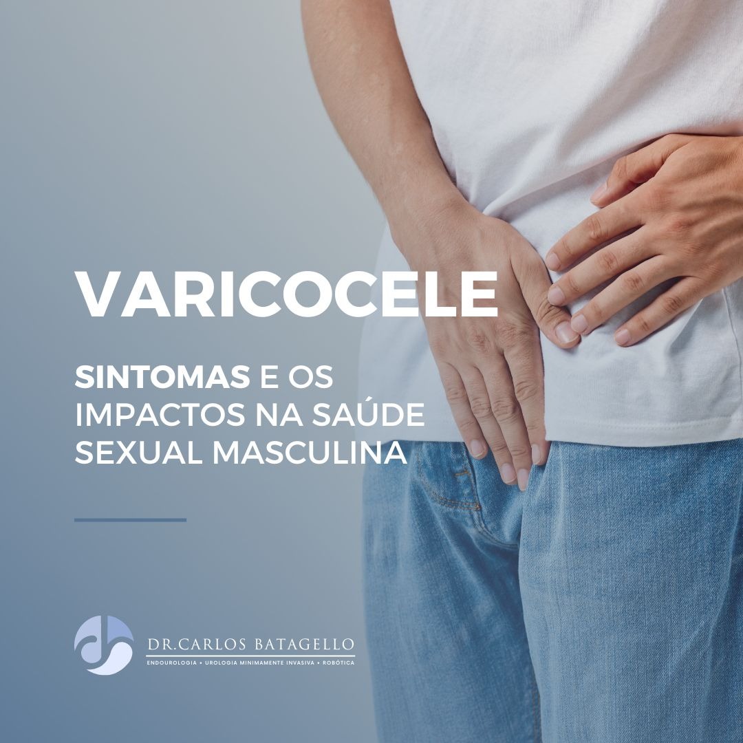 A varicocele é definida como a dilatação anormal e tortuosa das veias do cordão espermático. 

Entenda quais são as complicações da varicocele para a fertilidade e saúde do homem: carlosbatagello.com.br/varicocele-sin…

#varicocelesintomas