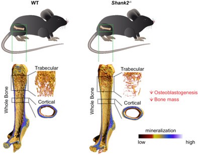 Authors from <a href="/uni_ulm/">Universität Ulm</a> show that the postsynaptic scaffold protein Shank2 is expressed in bone and that Shank2 levels are increased during osteoblastogenesis #openaccess #freetoread @AnitaIgnatius <a href="/JanTuckermann/">Jan Tuckermann</a>  <a href="/ASBMR/">ASBMR</a> 

ow.ly/Yup950M9Vcs