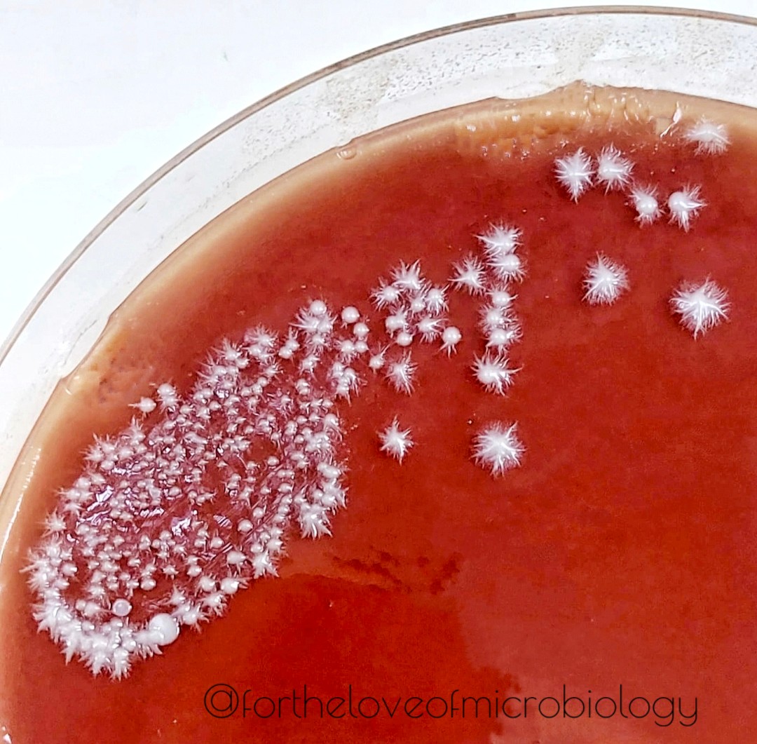 Candida albicans on chocolate agar,  with starry projections

#Fortheloveofmicrobiology #clinicalmicrobiology #mmidsp #microrounds #IDpath #ASMClinMicro
#MicroTwitter #WomenInSTEM #WomeninMicrobiology #STEM #medtwitter #ClinMicro #microbiologypakistan #PathBugs