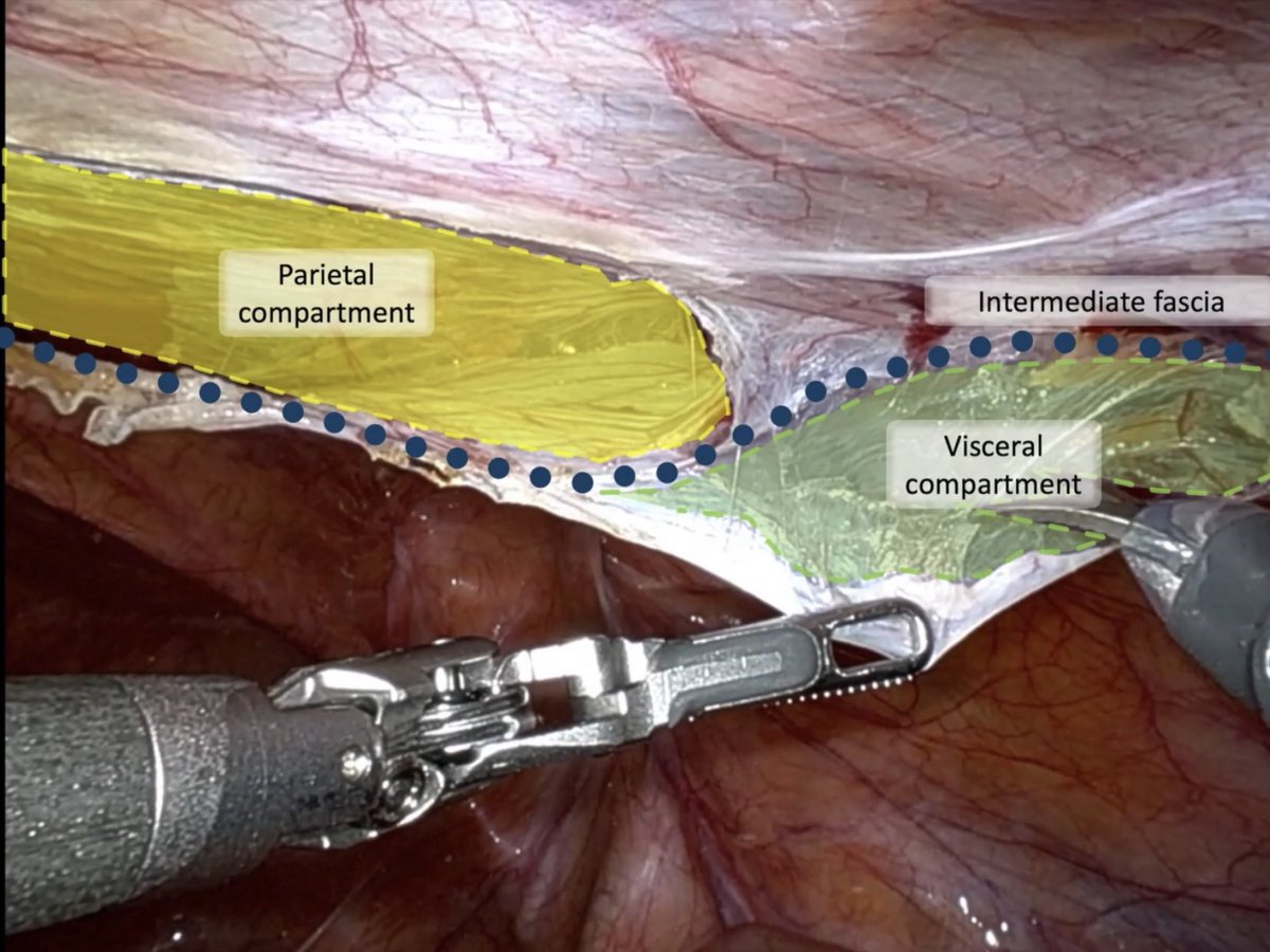 Vahagn C. Nikolian, MD tweet media