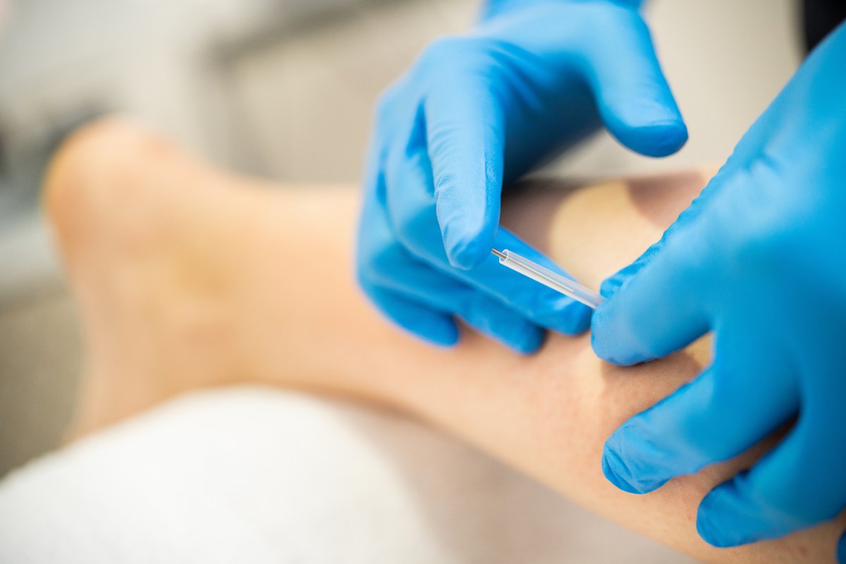 Trademarkpc's tweet photo. Has your pain left you feeling frustrated? Dry needling therapy is a safe and effective treatment method to reduce pain and muscle tension while improving mobility. 👍🏽

https://t.co/XPEYJl6m4J

#TrademarkPerformance #physicaltherapy #physicaltherapist #dryneedling https://t.co/cdVQV3rUJL