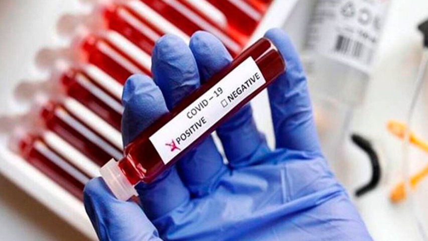 Virólogo de referencia alemán afirma que la covid ya se ha vuelto endémica dlvr.it/Sfygz6