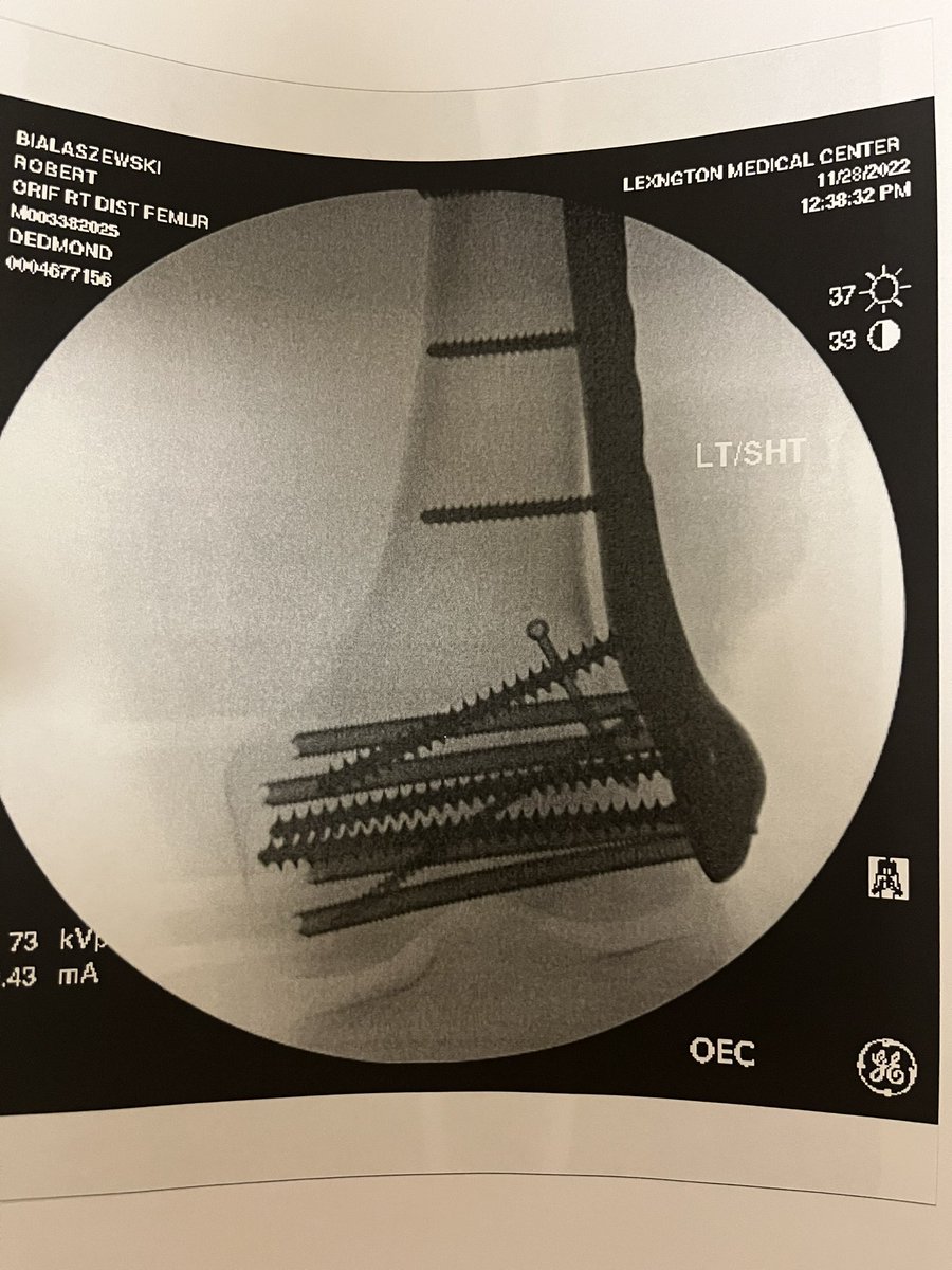 r_bialaszewski's tweet photo. Please consider donating/sharing  to our Go Fund Me that my sister &amp; friends of ours started. I was in a serious dirt bike accident back on Nov 26 and I cannot put any weight on my legs until the beginning of March. https://t.co/nJGHzS3z8H #BillsMafia #Motocross #GoFundMe https://t.co/EBa6DOYjpR