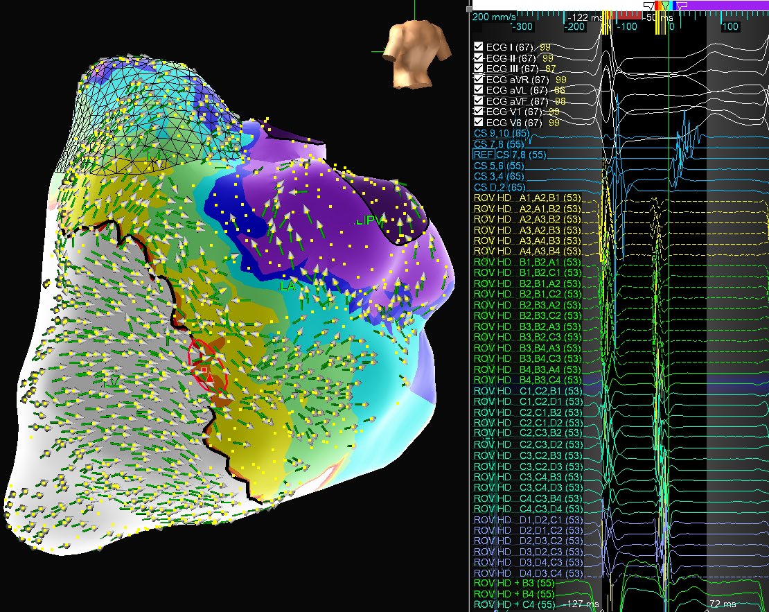 W2 Mappers tweet media