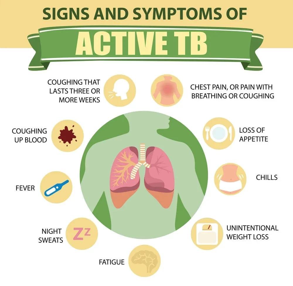 ml56's tweet image. 'Enhanced masking' now required for workers at True North Salmon in Black's Harbour, with 3 hours set aside for TB testing, on site tomorrow, by Public Health. "Active TB" has been diagnosed in one worker; test results to be available on Thurs for those selected to be tested Tues