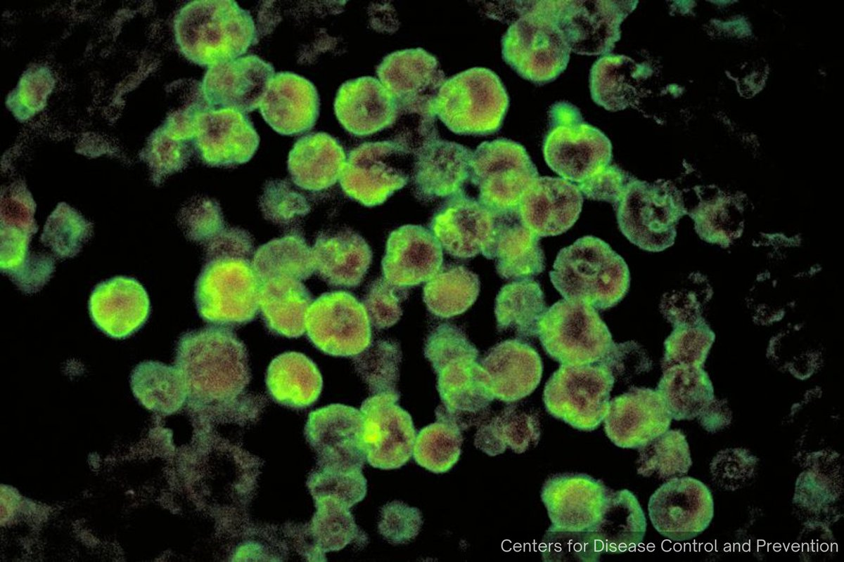 NewsBFM's tweet photo. 1. South Korea has reported its first death from Naegleria fowleri, commonly known as “brain-eating amoeba”. 

The Korea Disease Control and Prevention Agency says the patient, who was in his 50s, had entered South Korea on Dec 10, after a four-month stay in Thailand. https://t.co/xkWkXxeDPP