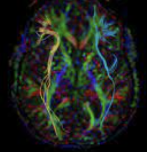 ecalixto's tweet photo. Un solo evento negativo puede persistir para TODA LA VIDA. 
Las conexiones neuronales de la amígdala cerebral se pueden modificar irreversiblemente solo por un ÚNICO EVENTO EXTREMADAMENTE ESTRESANTE.
#NeuroTuit https://t.co/2Hrp3oVRIE