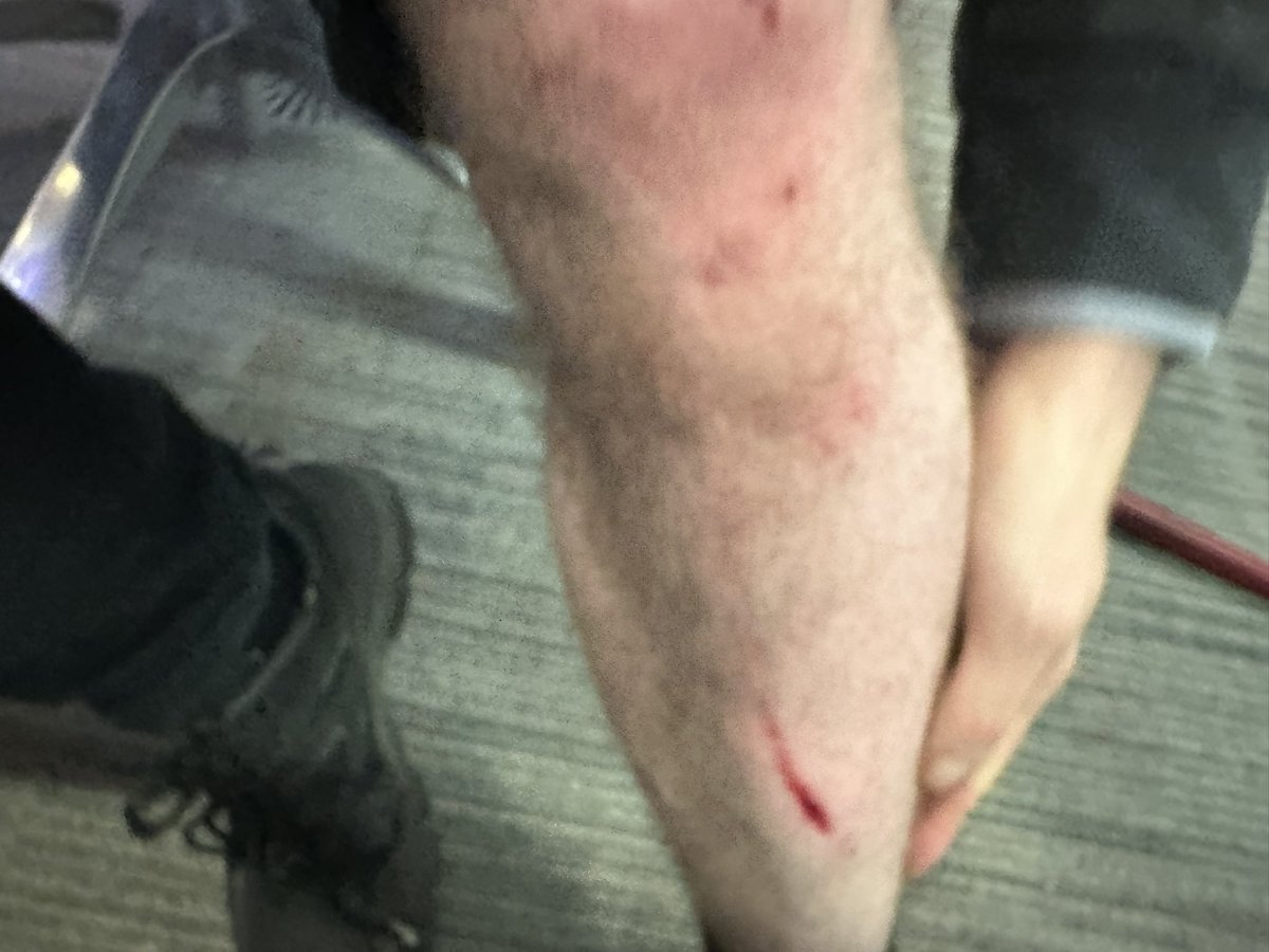 Sean Dilley NEWS tweet media