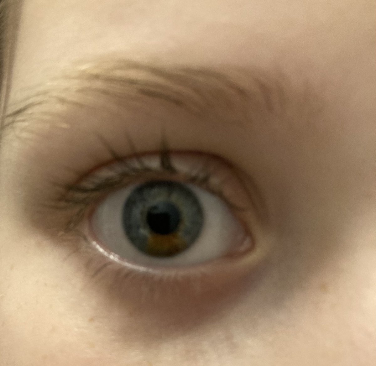 DrWhoWhatWhyHow's tweet photo. So, my 9yo has sectoral heterochromia and would like to see pics from any of you anywhere in the world who also has heterochromia!

Please RT if willing. I want her to see the beauty in this incredible trait❤️ https://t.co/29QUwDhYok