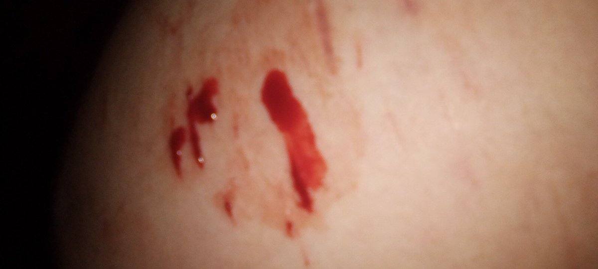 e_gg_s__'s tweet photo. i couldnt do alot :( https://t.co/monuRQmZst