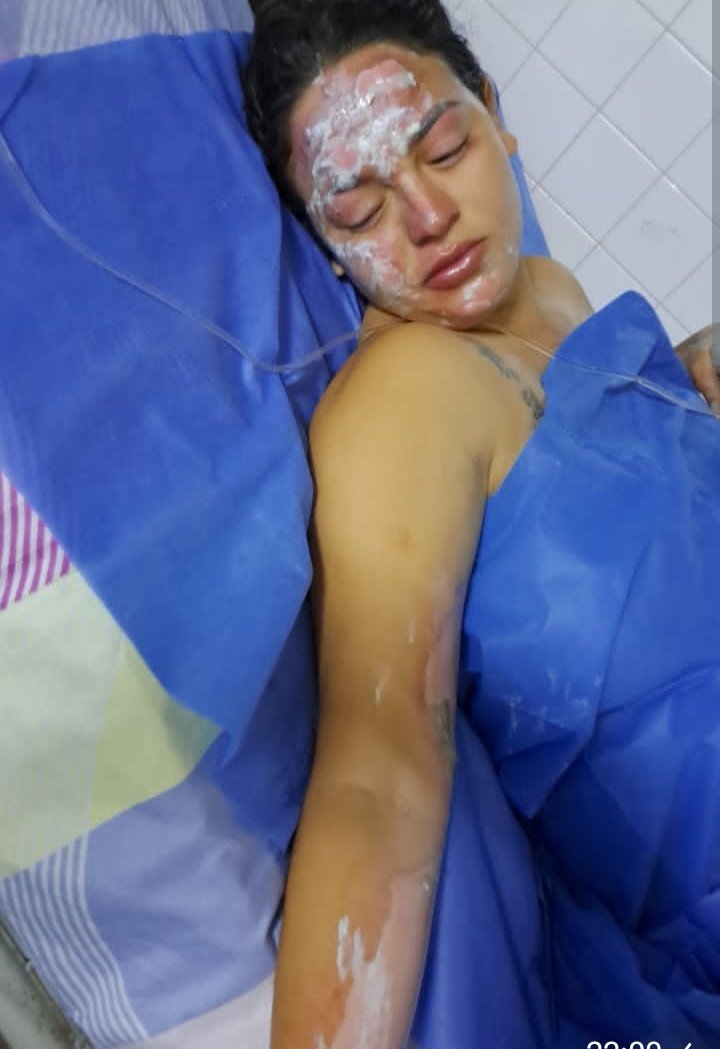 JosmaLocutora's tweet photo. Tanto leerlo en esta red y hoy ocurrió en mi pueblo Coloncito #Táchira: una joven fue atacada por el padre de sus hijos.Le roció gasolina y le prendió fuego. Tiene quemaduras de segundo grado.El cobarde huyó.Por favor, ayúdenme a difundir mencionando al Fiscal. 
@TarekWiliamSaab https://t.co/lQGVP7QIOI