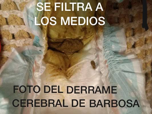 jmavocat's tweet photo. @lopezobrador_ Se le salió el relleno 🤣 https://t.co/Q3DDC2PFw2