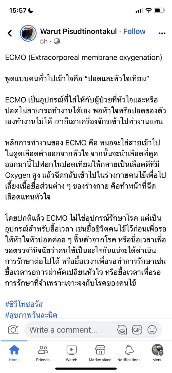 aorwiki's tweet photo. ใน #ข่าวลือ นั้น พูดถึง ECMO  นี่เลยไปเสือกมา การเสือกที่มีคุณภาพ เราต้องเอ้ดดูเขตไปด้วย https://t.co/3moC3y5N4D