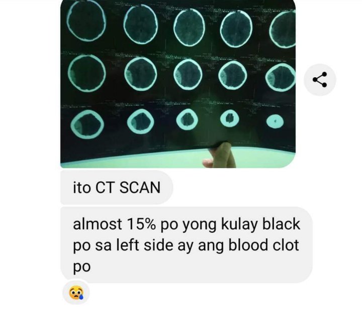 ‼please boost‼(not esbi related)

Hello moots! I have a classmate who got confined yesterday dahil naaksidente sa palaro, nagka blood cloth sya and medyo malaki yung bayarin kaya his fam is needing help, pls help them po:( help rt!!!

gcash number: 09083028692