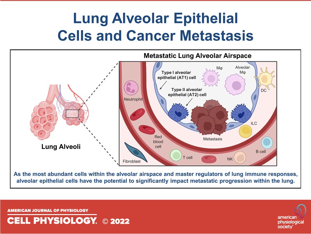 AJPCellPhys's tweet photo. The underappreciated role of resident #EpithelialCell populations in metastatic progression: contributions of the #lung alveolar #epithelium
https://t.co/cYnimc0uzD
#review #metastasis #cancer https://t.co/QVHxndiUEd