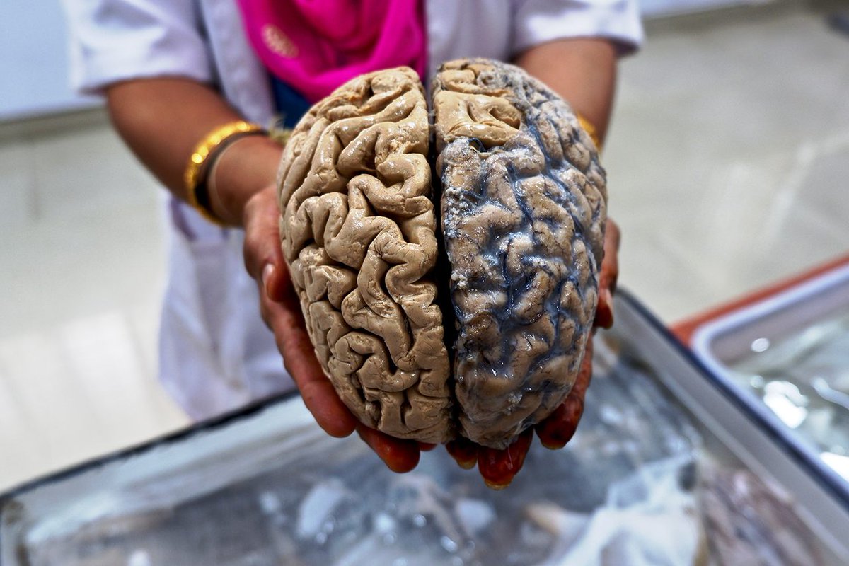 Gerontology @ WSU (@iogwsu) on Twitter photo Some folks stay sharp into their 80s, 90s, even past 100! It’s not luck alone that keeps them healthy. "Call Me Curious" podcasters asked how to keep our brains young & <a href="/DrAnaDaugherty/">Ana M Daugherty</a>
answered. She heads the Healthy Brain Aging lab <a href="/IOGWSU/">Gerontology @ WSU</a>
wondery.com/shows/call-me-… Some folks stay sharp into their 80s, 90s, even past 100! It’s not luck alone that keeps them healthy. "Call Me Curious" podcasters asked how to keep our brains young & <a href="/DrAnaDaugherty/">Ana M Daugherty</a>
answered. She heads the Healthy Brain Aging lab <a href="/IOGWSU/">Gerontology @ WSU</a>
wondery.com/shows/call-me-…