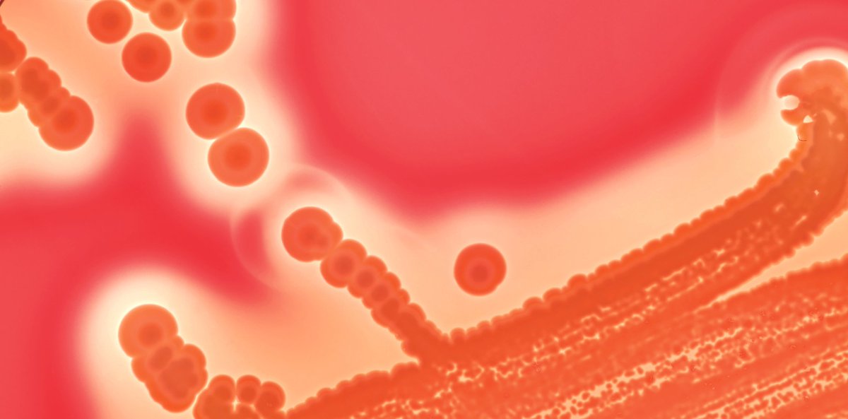 PittMedMag's tweet image. “Seeing evolution happen in real time is just so captivating,” says @vscooper, a professor @PittHealthSci &amp;amp; founder of @EvolvingSTEM, which provides high school students with an evolution-in-action 3D curriculum and kit. #ScienceTwitter #highschoolscience pi.tt/mutantsummer