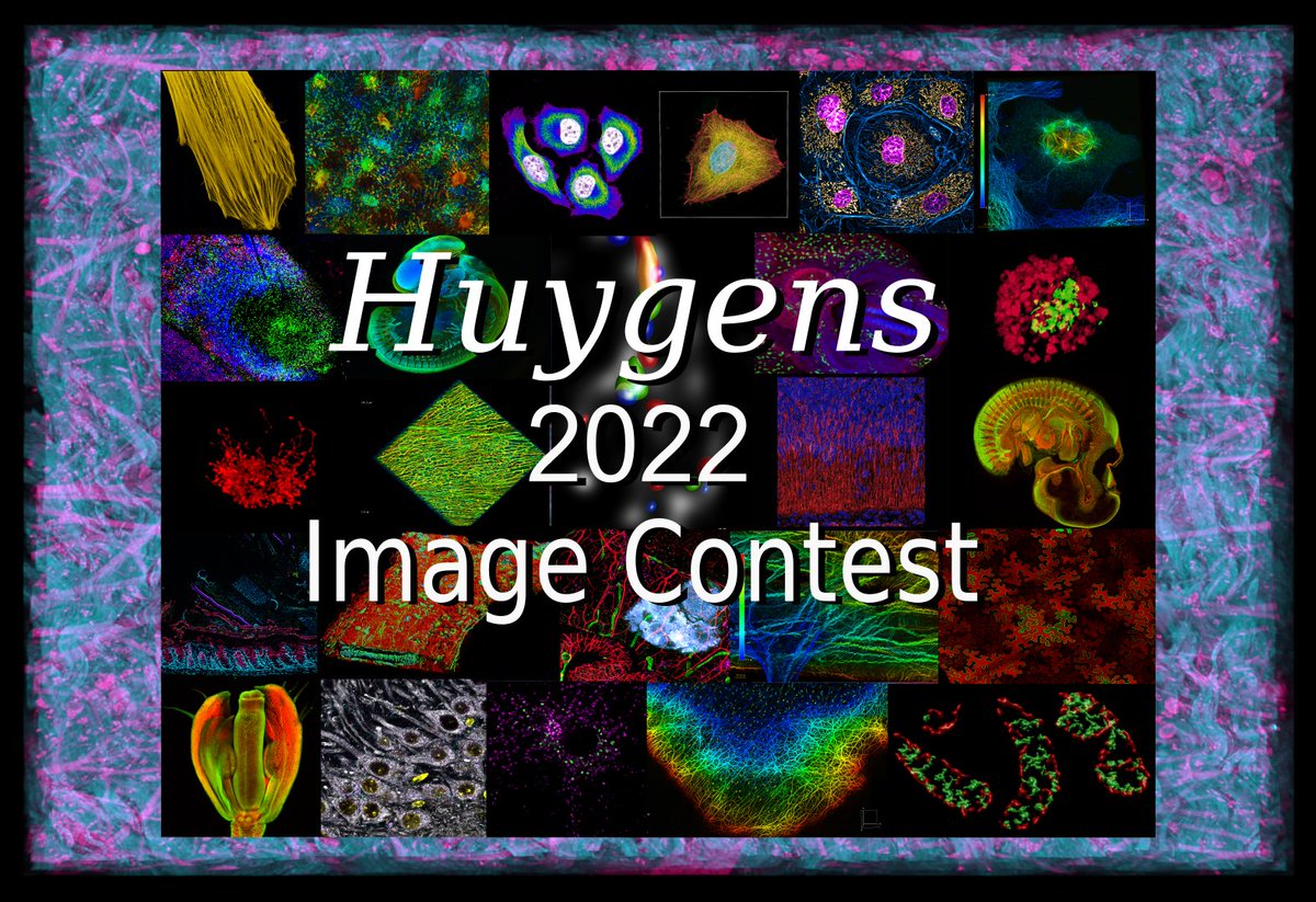 We celebrate #microscopy #scienceart! Join our image contest untill Dec 20: svi.nl/ImageContest and win a laptop, hard drive and eternal fame! #Science #sciart