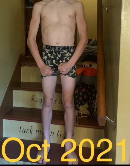EDISONFOOTBALL4's tweet photo. This is a one year transformation of one of our middle school football-wrestling-baseball players. Our 7th and 8th graders have been putting in the work 5 days a week in our strength training class.  Metal Sharpens Metal!!
#onlyatEdison https://t.co/srtwRxyeXl