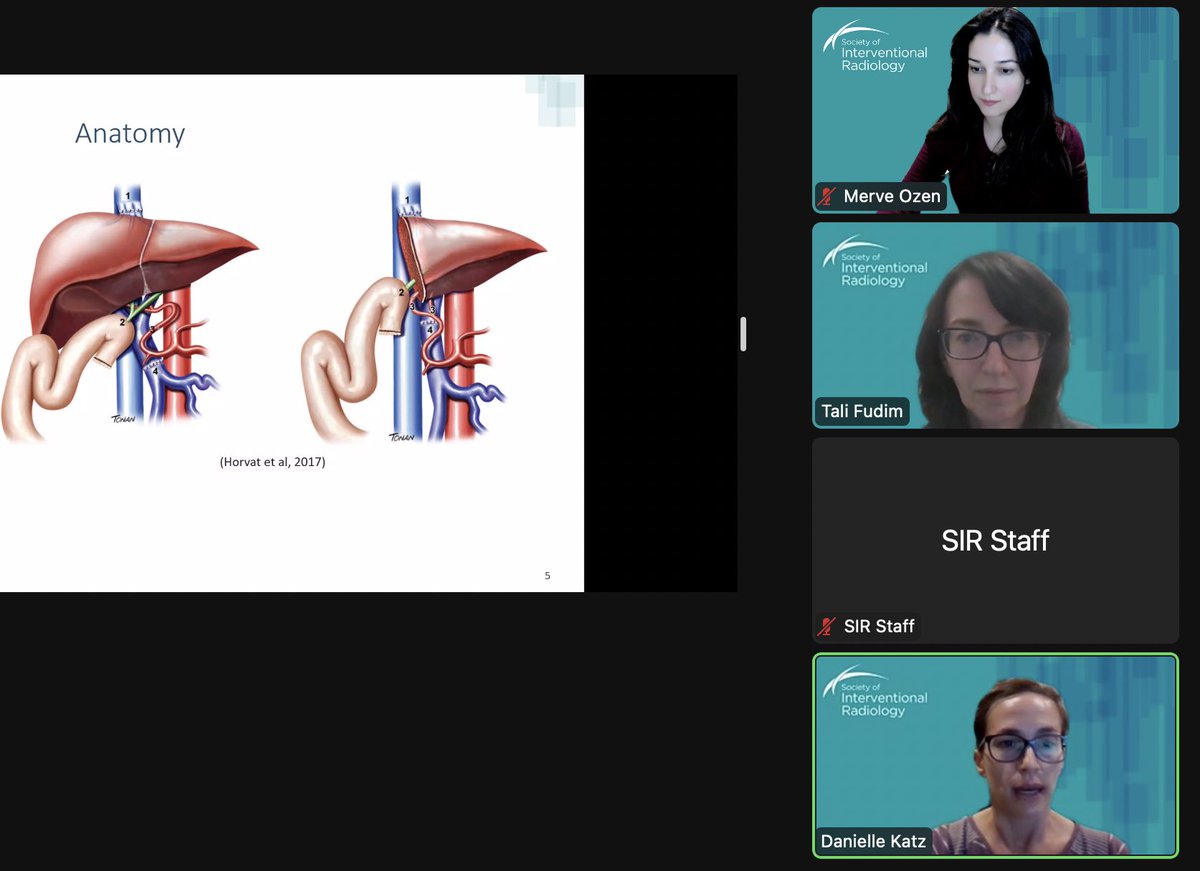 Merve Ozen (@merveozenmd) on Twitter photo I was honored to be invited to <a href="/SirNP_PASection/">SIR NP and PA Section</a>’s first webinar: Biliary Interventions roundtable. I highly recommend checking the recording at #SIRNow #IRad I was honored to be invited to <a href="/SirNP_PASection/">SIR NP and PA Section</a>’s first webinar: Biliary Interventions roundtable. I highly recommend checking the recording at #SIRNow #IRad
