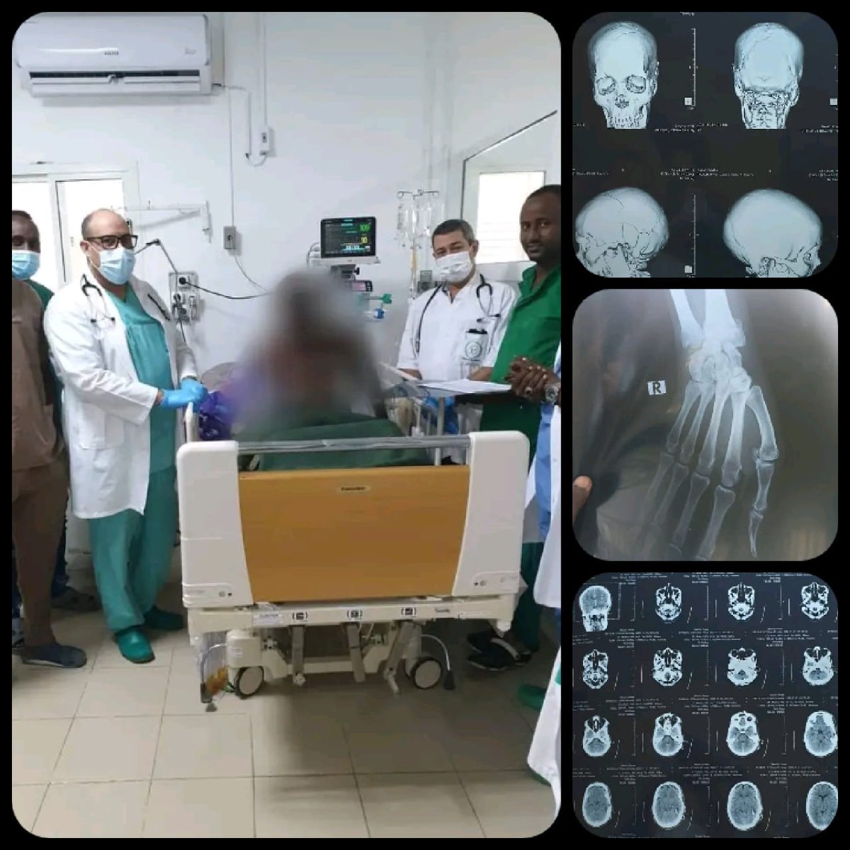 En la Sala de Terapia Intensiva del Hospital General Peltier en 🇩🇯, los Drs: Duniesky Tejedor y Enrique Cantillo, aplican tratamiento  protocolizado a pacientes politraumatizados con excelentes resultados. #CubaSalvaVidas #CubaCoopera
<a href="/CubacooperaDj/">Cubacoopera Djibouti</a>