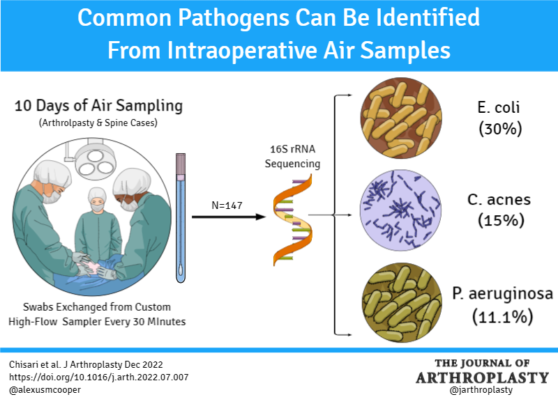 You may be surprised to discover common pathogens in your OR air. #ecoli #cacnes #pseudomonas @womenAAHKS @Ortho_Deck @KevinWeiszMD @kimtuckinAZ @BrdgPlt2Nowhere @CenterRotation @DrPeterGold arthroplastyjournal.org/article/S0883-… #visualabstract by Dr. Alexus Cooper @alexusmcooper