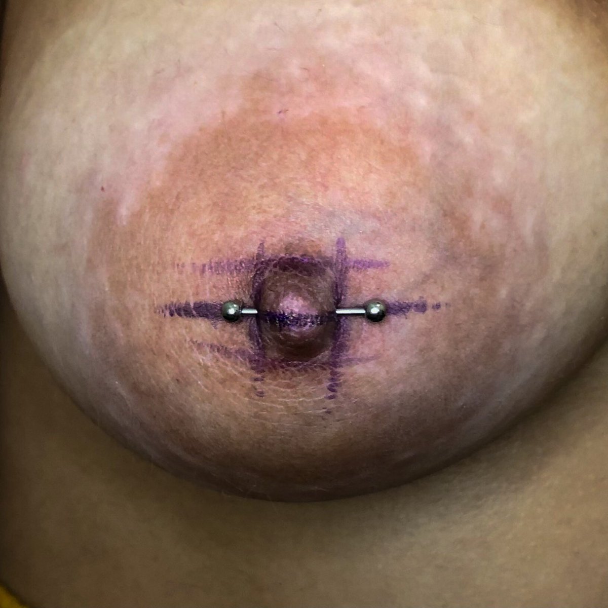 joycaiuby's tweet photo. Mamilinhos que rolaram hoje, na régua 📏 
Esperar o tempo da cicatrização inicial para fazer o downsize.
#nipplepiercing #piercingmamilo https://t.co/7zQHrunpLe