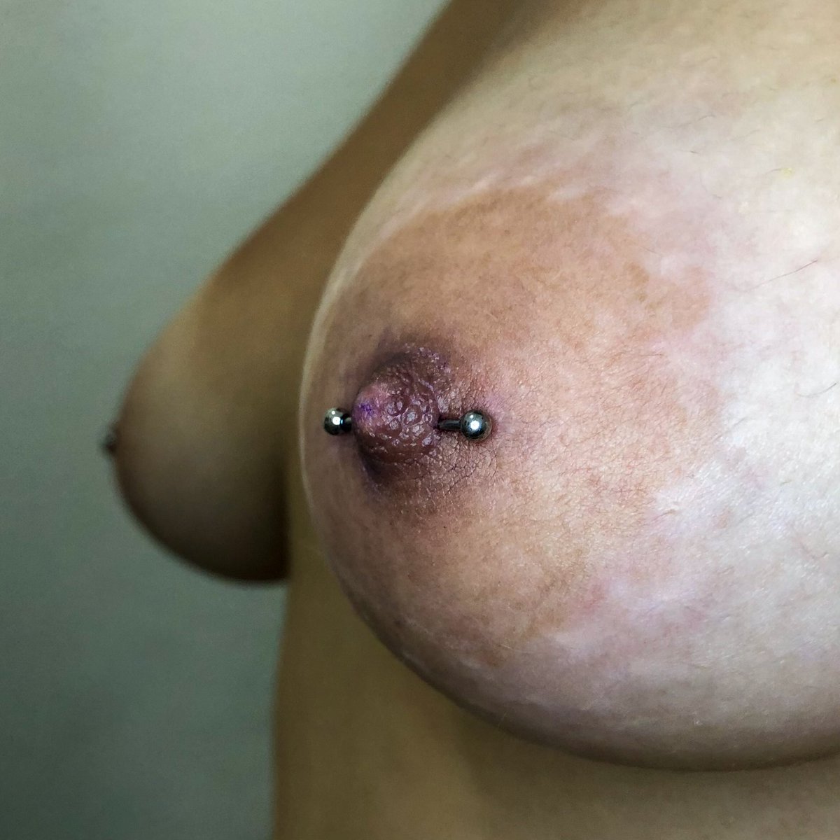 joycaiuby's tweet photo. Mamilinhos que rolaram hoje, na régua 📏 
Esperar o tempo da cicatrização inicial para fazer o downsize.
#nipplepiercing #piercingmamilo https://t.co/7zQHrunpLe