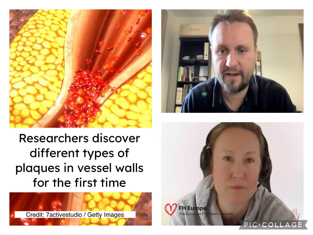 fhpatienteurope's tweet photo. Use of #AI helped identify 5 new #atherosclerotic #plaques. We connected with Michal Mokry to discuss the implications of the findings for patients with #ASCVD, specifically with inherited #CVD risk factors like #FH and #Lpa. 

Lay summary of the findings https://t.co/JGJ8lddHLa https://t.co/nOFgVSmJjS