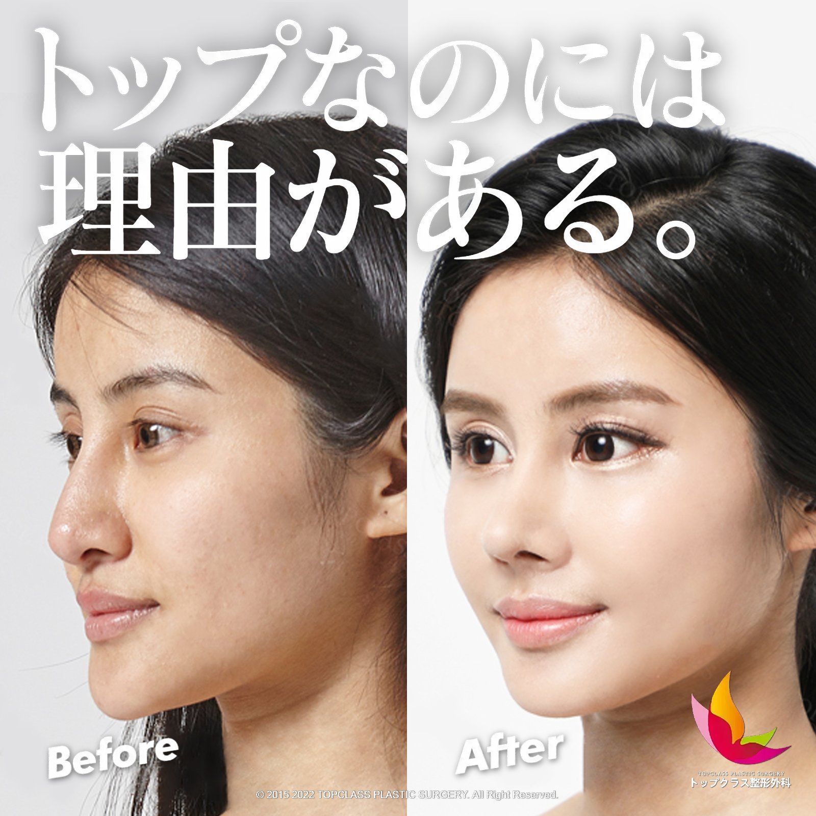 童顔整形 Twitter Search Twitter