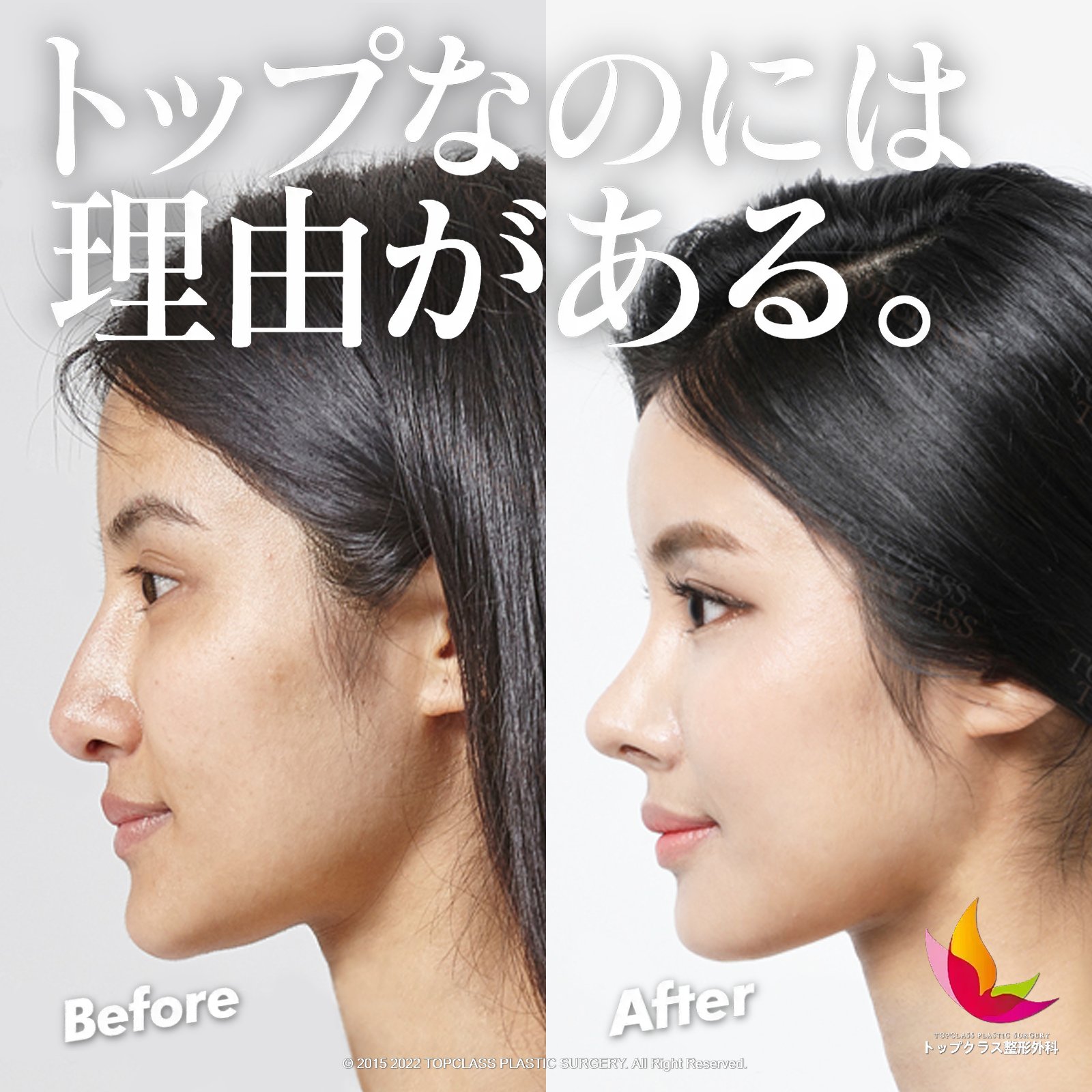 童顔整形 Twitter Search Twitter