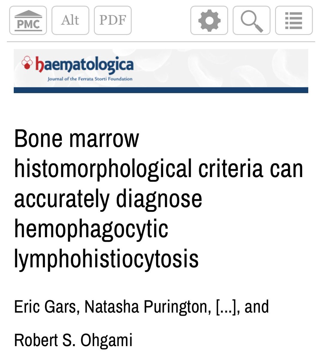 rajeswari52's tweet image. Ever wondered, in a case with 4/8 criteria for HLH,with BM showing fewer phagocytic histios, how many are needed to qualify for 5th criteria? This paper saved my day! 1 engulfed gran, 4 engulfed nrbcs/1000 cells or one with multiple nucleated cells is highly associated with HLH.
