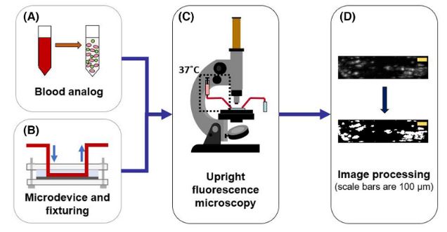 Artificial Organs (@artiforgans) on Twitter photo The roles of #SubMicron and #Microscale roughness on shear-driven #Thrombosis on #TitaniumAlloy surfaces
👉bit.ly/3Wrg0Md
<a href="/Cornell/">Cornell University</a> <a href="/ProfBrianKirby/">Professor Brian J. Kirby</a> #Adhesion #Embolism #Platelets The roles of #SubMicron and #Microscale roughness on shear-driven #Thrombosis on #TitaniumAlloy surfaces
👉bit.ly/3Wrg0Md
<a href="/Cornell/">Cornell University</a> <a href="/ProfBrianKirby/">Professor Brian J. Kirby</a> #Adhesion #Embolism #Platelets