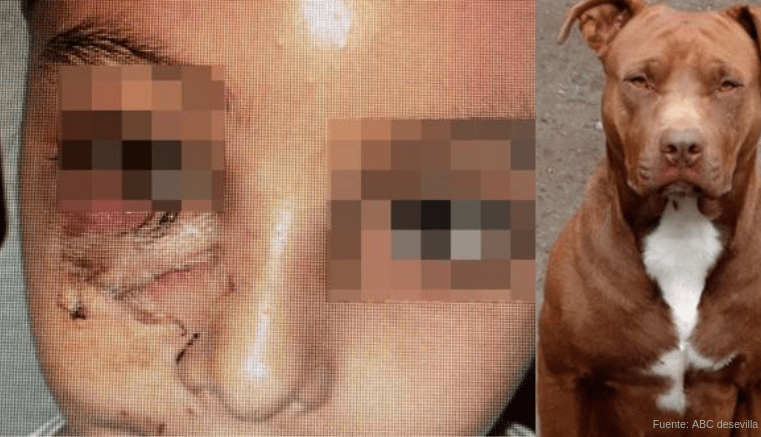 EsGenerales's tweet photo. Perro pitbull ataca a niña en una fiesta

Una fiesta donde se celebraba una primera comunión, término de muy mala manera. Esto debido a que un perro peligroso se abalanzó sobre una de las asistentes,.....

#pitbullmuerdeaniña #Pitbullsalvaje

https://t.co/flCs5j0orz https://t.co/WZUeTrxES4