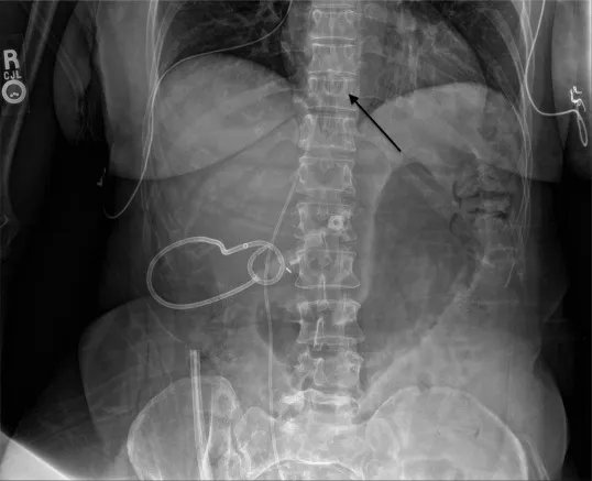 European Urology Open Science tweet media