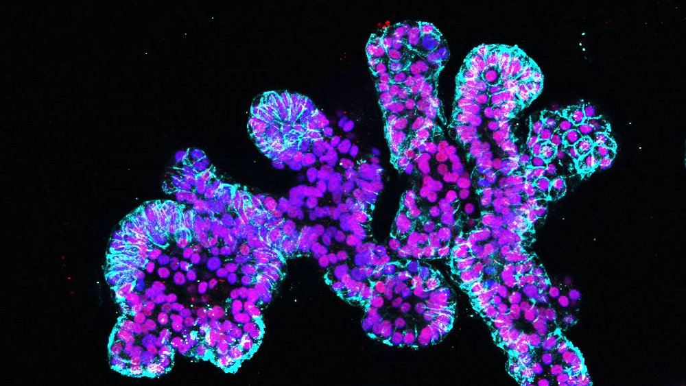 We have an <a href="/LabRawlins/">Rawlins Lab</a> <a href="/GurdonInstitute/">Gurdon Institute</a> <a href="/PDN_Cambridge/">PDN Cambridge</a> <a href="/wellcometrust/">Wellcome</a> funded postdoctoral position available to work on a highly collaborative project using organoids and CRISPR tools to explore the genetic contribution to lung disease. Questions welcome: jobs.cam.ac.uk/job/38638/