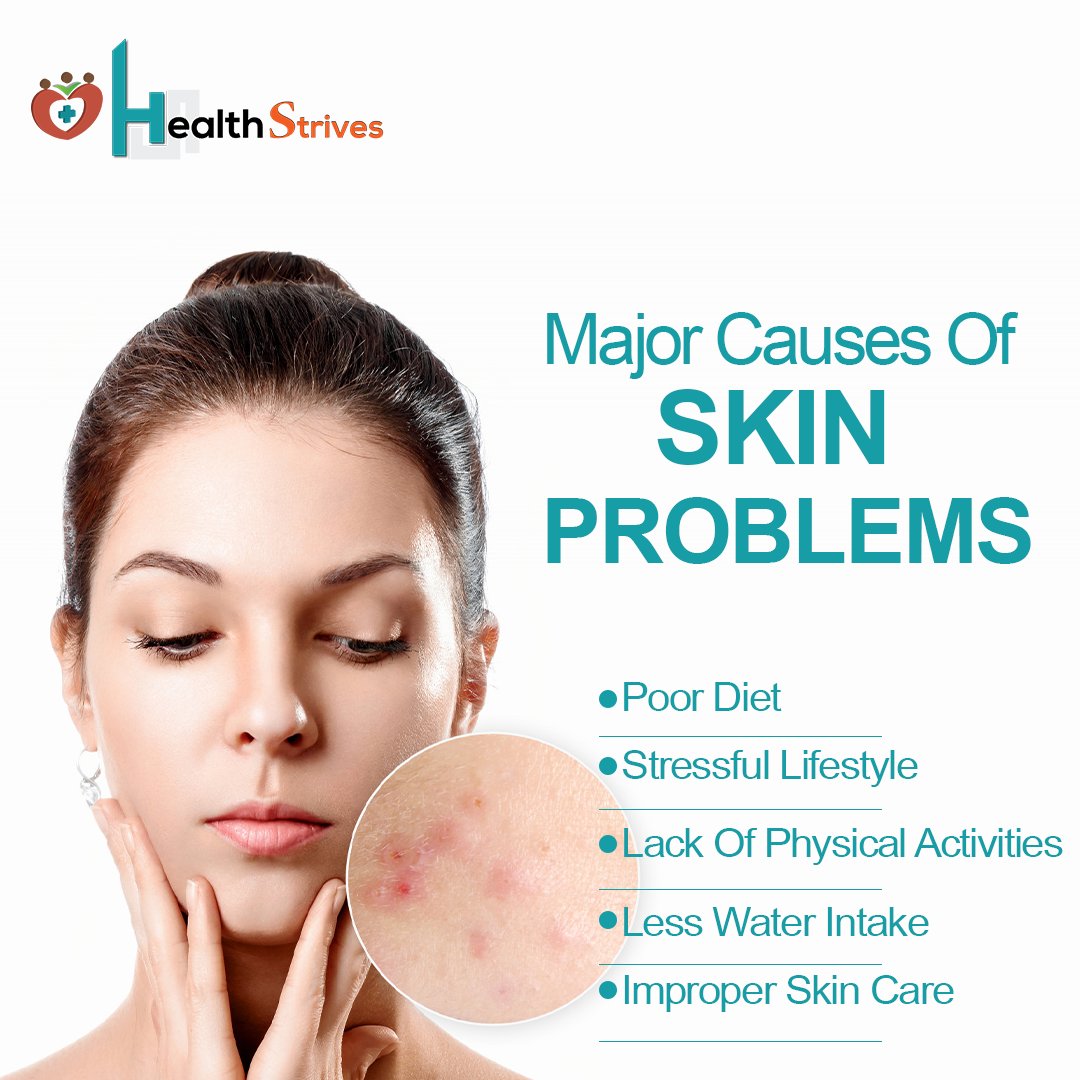 healthstrives's tweet photo. Healthy Food + Proper Care = Glowing Skin
Do you have patchy skin or early ageing signs? It simply means that you are not giving it the care it requires.
#healthstrives #skincare #skin #skinproducts #skinproblems #skincareroutine #healthyskin #darkskin #skinissue #dullface https://t.co/15nFvZrQz1