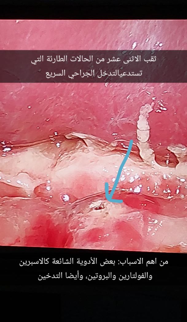 Amer Alshahrani د.عامر الشهراني (@amersalshahrani) on Twitter photo 